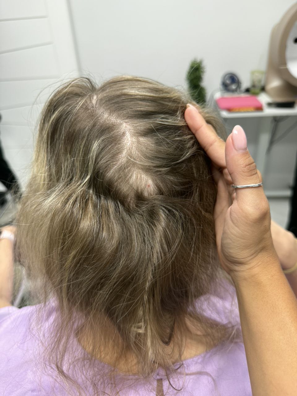 Before treatment — crown